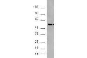 HEK293 overexpressing AKT3 and probed with ABIN2561021 (mock transfection in second lane). (AKT3 antibody  (Internal Region))