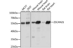 Western blot analysis of extracts of various cell lines, using ZSCAN21 antibody. (ZSCAN21 antibody)
