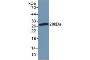 Western Blotting (WB) image for anti-Nuclear Factor of kappa Light Polypeptide Gene Enhancer in B-Cells 2 (NFKB2) (AA 25-224) antibody (ABIN7434146)