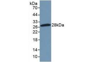 Detection of Recombinant NFkB2, Mouse using Polyclonal Antibody to Nuclear Factor Kappa B2 (NFkB2) (Nuclear Factor kappa B2 (AA 25-224) antibody)