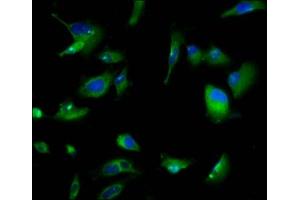 Immunofluorescence staining of U251 cells with ABIN7164465 at 1:166, counter-stained with DAPI. (GPR158 antibody  (AA 882-1003))