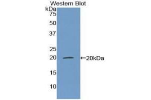 Western blot analysis of recombinant Mouse MGP. (MGP antibody  (AA 20-104))