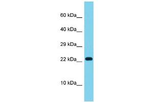 Host: Rabbit Target Name: ATP5S Sample Type: ACHN Whole cell lysates Antibody Dilution: 1. (ATP5S antibody  (N-Term))