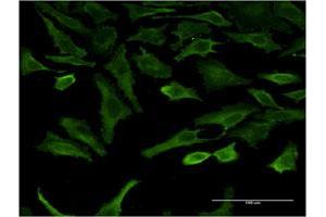 Immunofluorescence (IF) image for anti-serum/glucocorticoid Regulated Kinase 2 (SGK2) (AA 244-344) antibody (ABIN523487)