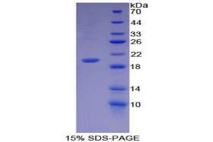 SDS-PAGE (SDS) image for Growth Differentiation Factor 7 (GDF7) (AA 295-447) protein (His tag) (ABIN2125108)