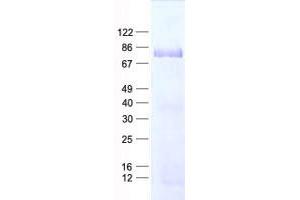 Validation with Western Blot