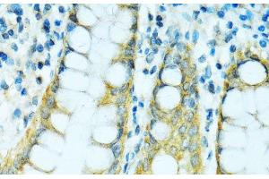 Immunohistochemistry of paraffin-embedded Human colon using CYP2B6 Polyclonal Antibody at dilution of 1:100 (40x lens). (CYP2B6 antibody)