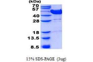 Image no. 1 for Mevalonate Kinase (MVK) protein (His tag) (ABIN1098525)