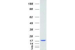 Validation with Western Blot (Cytochrome b5 (CYTB5) (Transcript Variant 1) protein (Myc-DYKDDDDK Tag))