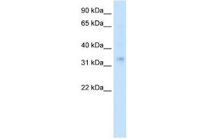 Human Muscle; WB Suggested Anti-HOXA2 Antibody Titration: 0. (HOXA2 antibody  (Middle Region))