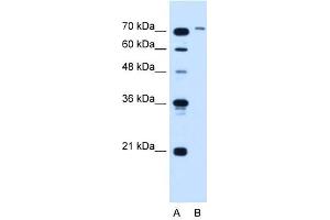 anti-Solute Carrier Organic Anion Transporter Family, Member 6A1 (SLCO6A1) (N-Term) antibody