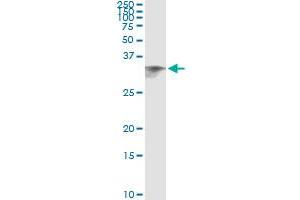 Immunoprecipitation of CIDEA transfected lysate using anti-CIDEA monoclonal antibody and Protein A Magnetic Bead , and immunoblotted with CIDEA MaxPab rabbit polyclonal antibody. (CIDEA antibody  (AA 1-253))