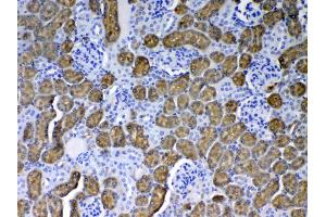 IHC analysis of PAH using anti-PAH antibody . (Phenylalanine Hydroxylase antibody  (AA 71-208))