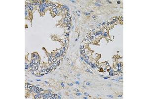 Immunohistochemistry of paraffin-embedded human prostate using EIF3H Antibody. (EIF3H antibody)