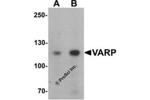 Western Blotting (WB) image for anti-Ankyrin Repeat Domain 27 (VPS9 Domain) (ANKRD27) (N-Term) antibody (ABIN1031656) (ANKRD27 antibody  (N-Term))