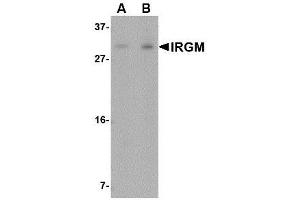 Image no. 1 for anti-Immunity-Related GTPase Family, M (IRGM) (N-Term) antibody (ABIN1494356) (IRGM antibody  (N-Term))