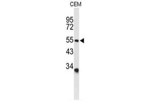 Western blot analysis of ACCN2 Antibody (C-term) in CEM cell line lysates (35 µg/lane). (ASIC1 antibody  (C-Term))