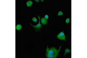 Immunofluorescent analysis of MCF-7 cells using ABIN7174064 at dilution of 1:100 and Alexa Fluor 488-congugated AffiniPure Goat Anti-Rabbit IgG(H+L) (SRMS antibody  (AA 19-155))