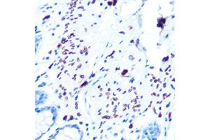 Immunohistochemistry of paraffin-embedded human colon using Emerin/EMD Rabbit mAb (ABIN7266933) at dilution of 1:100 (40x lens).
