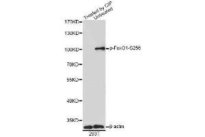 Western blot analysis of extracts of 293T cells, using Phospho-FoxO1-S256 antibody (ABIN5969947) at 1/1000 dilution. (FOXO1 antibody  (pSer256))