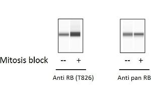 HT29 cells were treated with Thymidine-Nocodazole Block. (Retinoblastoma 1 ELISA Kit)