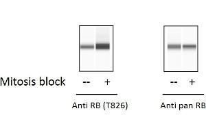 HT29 cells were treated with Thymidine-Nocodazole Block.