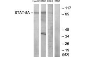 Western Blotting (WB) image for anti-Signal Transducer and Activator of Transcription 5A (STAT5A) (AA 666-715) antibody (ABIN2889069) (STAT5A antibody  (AA 666-715))