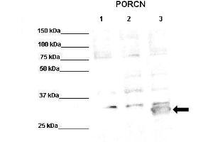 WB Suggested Anti-PORCN Antibody  Positive Control: Lane1: 50ug PORCN-KO HT1080 (microsomes), Lane2: 50ug HT1080 (microsomes), Lane3: 50ug PORCN transfected HT1080 (microsomes)  Primary Antibody Dilution :  1:500 Secondary Antibody :  Anti-rabbit-HRP  Secondry Antibody Dilution :  1:10,000 Submitted by: Anonymous (PORCN antibody  (Middle Region))