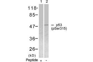 Western Blotting (WB) image for anti-Tumor Protein P53 (TP53) (pSer315) antibody (ABIN7138550)
