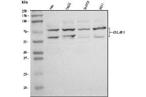 Western blot analysis of GLB1/Beta-galactosidase using anti-GLB1/Beta-galactosidase antibody (ABIN7601806).
