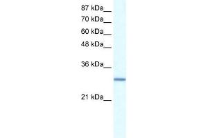 Human Daudi; WB Suggested Anti-GTF2E2 Antibody Titration: 0. (GTF2E2 antibody  (N-Term))