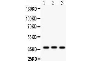 Western Blotting (WB) image for anti-Connective Tissue Growth Factor (CTGF) (AA 58-349) antibody (ABIN3042771) (CTGF antibody  (AA 58-349))