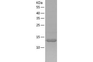 BAZ1A Protein (AA 1415-1545) (His tag)