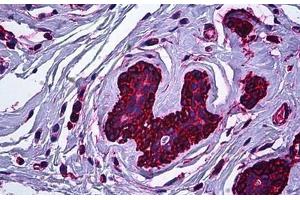 Human Breast: Formalin-Fixed, Paraffin-Embedded (FFPE) (Myosin 9 antibody)