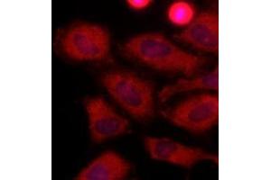Immunofluorescenitrocellulosee of human HeLa cells stained with Hoechst 3342 (Blue) for nucleus staining and monoclonal anti-human LDHA antibody (1:500) with Texas Red (Red). (Lactate Dehydrogenase A antibody  (AA 1-332))