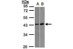 WB Image Sample(30 ug whole cell lysate) A:A431, B:Raji , 10% SDS PAGE antibody diluted at 1:1000 (MBNL3 antibody)
