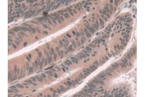 Immunohistochemistry (IHC) image for anti-ATPase, Cu++ Transporting, beta Polypeptide (ATP7B) (AA 59-426) antibody (ABIN7441340)