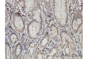 Immunoperoxidase of monoclonal antibody to ARVCF on formalin-fixed paraffin-embedded human stomach. (ARVCF antibody  (AA 863-962))