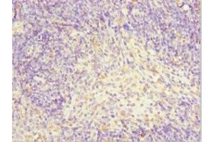 Immunohistochemistry of paraffin-embedded human thymus tissue using ABIN7143883 at dilution of 1:100 (TFCP2 antibody  (AA 1-280))