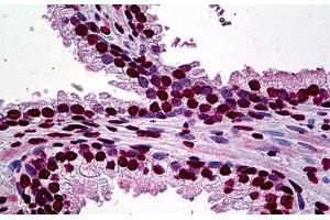 Human Prostate: Formalin-Fixed, Paraffin-Embedded (FFPE) (AFT1 antibody  (AA 1-272))
