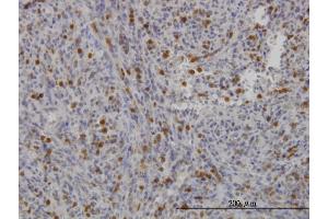 Immunoperoxidase of monoclonal antibody to FGR on formalin-fixed paraffin-embedded human spleen. (Fgr antibody  (AA 1-90))