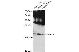 Western blot analysis of extracts of various cell lines, using RA antibody (ABIN7269801) at 1:1000 dilution. (RAB22A antibody  (AA 1-100))