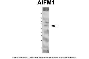WB Suggested Anti-AIFM1 Antibody Titration: 1 ug/mlPositive Control: Rat tissue (AIF antibody  (Middle Region))