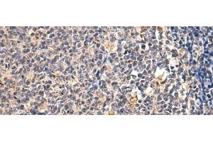 Immunohistochemistry of paraffin-embedded Human tonsil tissue using ENTPD1 Polyclonal Antibody at dilution of 1:60(x200) (CD39 antibody)