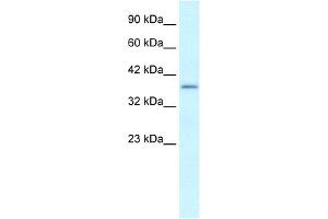 WB Suggested Anti-SOX18 Antibody Titration:  0. (SOX18 antibody  (Middle Region))