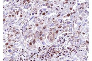 ABIN6268706 at 1/100 staining human lung tissue sections by IHC-P. (SMAD6 antibody  (Internal Region))