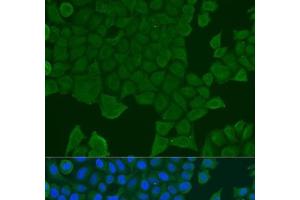 Immunofluorescence analysis of U2OS cells using REEP1 Polyclonal Antibody at dilution of 1:100.