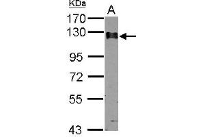 Western Blotting (WB) image for anti-Calpastatin (CAST) (AA 275-700) antibody (ABIN1497106) (Calpastatin antibody  (AA 275-700))