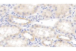 Detection of TNFb in Human Kidney Tissue using Monoclonal Antibody to Tumor Necrosis Factor Beta (TNFb) (LTA antibody  (AA 36-205))