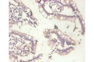 Immunohistochemistry of paraffin-embedded human small intestine tissue using ABIN7159509 at dilution of 1:100 (MT1A antibody  (AA 1-59))